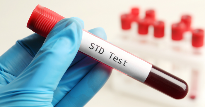 Hand mit blauem Handschuh hält Blutprobe mit Aufschrift STD Test, Gesundheit, Sicherheit